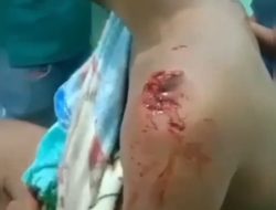 Video Lengan Pria Putus Akibat Diterkam Harimau Saat Melintas di Hutan Baluran Situbondo Hoax, Ternyata Ini Faktanya