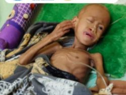 Relawan di Kotim Galang Dana untuk Bocah Penderita Tumor Hati